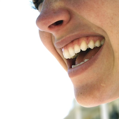 Image of smiling woman to show gums and explain Midtown Periodontics in New York